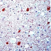 Anti-beta Synuclein antibody used in IHC (Paraffin sections) (IHC-P). GTX15532
